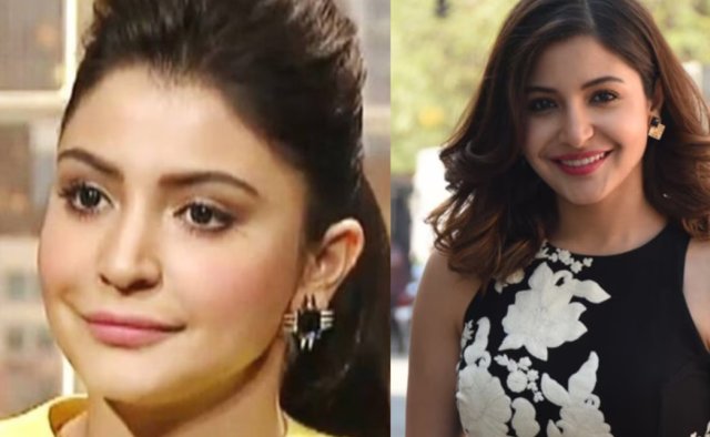 Plastic Surgery hedhi kamag Anushka ehbasvi!