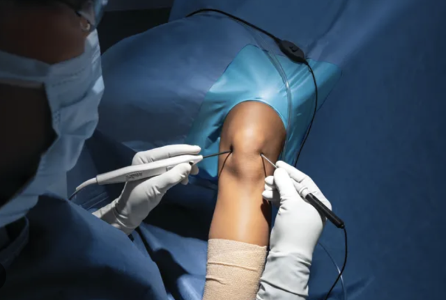 Raajjey gai mulhin alah 'Nano Needle' beynun koigen surgery thah kuran fashaifi 