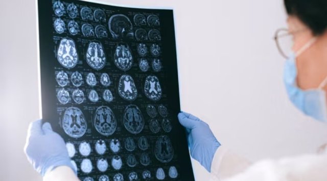 Stress kamah heekoh dhookohlevey 7 kameh: Sikundeege tumor ehge furathama alaamaai thah!