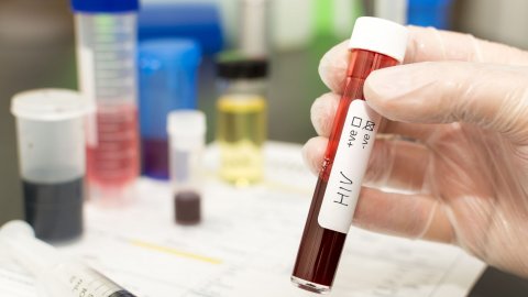 HIV jehifaivaa ithuru meehakah Stem cell transplant in faruvaa dheefi