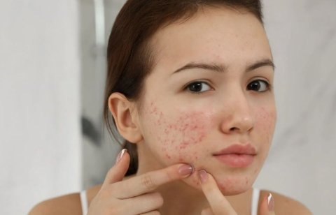 Moonugai oshaalha nagan medhuveri vaa aanmu baeh sababu thah!